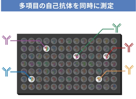 多項目の自己抗体を同時に測定